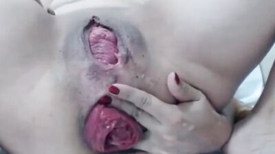 Kinky woman with stretched anus is gaping that butt at webcam